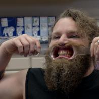 No more braces for Gabe!